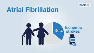 SciComm Teaser: Patient-Led Mass Screening for Atrial Fibrillation in Seniors Using Handheld ECGs