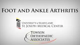 Foot and Ankle Arthritis - Jeffrey Brodie, MD - Towson Orthopaedic Associates