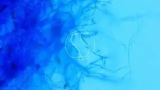 Bipolaris with Lactophenol Cotton Blue Stain, Bright Field and Phase Contras Microscopy