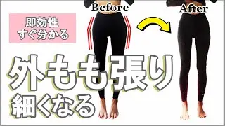 【大転子すぐ引っ込む】外もも張り痩せる方法【即効果あり】