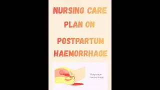 Nursing care plan on postpartum haemorrhage#bse #gnm #ncp #obgyn #obg #gynecology #midwifery #ncp
