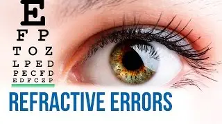 Refractive errors of the eyes