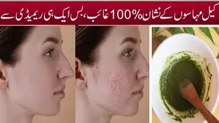 Apply Diy Homemade Neem Face Pack For Acne&Pimples and Dark Sports#diyremedies#pimples
