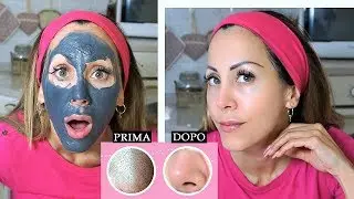 PULIZIA DEL VISO Top!!! Toglie TUTTI I PUNTI NERI e le IMPERFEZIONI!!! | Carlitadolce