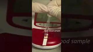 Instant Blood Wellness Check: Hemoglobin Results in Under 15 Seconds!