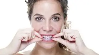 Eccella Smiles - What is Invisalign?