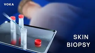 Skin Biopsy Explained: A 3D Visualization of Punch, Shave & Excision Techniques