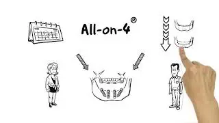 All on 4 Concept at Castle Clinic Specialist Oral Surgery Practice Dalkey