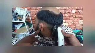 18, January 2023, Hair Patch, Clipping, Tapping, Bounding, Fixing, Hair Replacement In Delhi_by