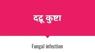 DADRU KUSHTA || Fungal  infections || Tenia infections ||