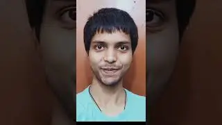 BALD TO LONG HAIR || 1YEAR TIMELAPSE #viral #hair #shorts #timelapse #hairtransformation #hairgrowth