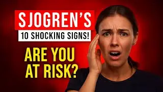 10 Warning Signs of Sjogrens Disease You Must Know!