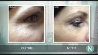 Nerium Before and After / Cylk Cozart