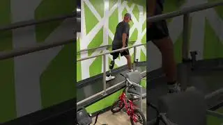 Three years into his amputee journey, this patient was curious about powered knees.