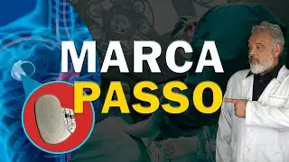 Precisa de  Marca-passo: O Que Ninguém Te Conta sobre Marcapassos.