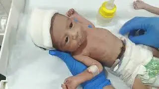 Premature Baby&rsquo;s First Formula Feeding in NICU | Gentle Care & Love 💖🍼