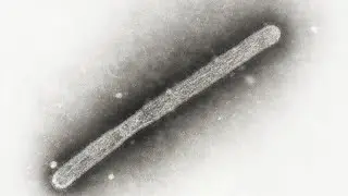 1st US case of bird flu in a pig