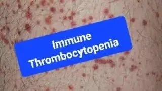 Immune Thrombocytopenia (ITP)