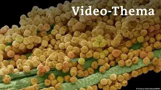 Deutsch lernen mit Videos | Allergien: Wenn das Immunsystem überreagiert | mit deutschen Untertiteln
