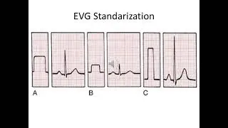 ECG standarization calibration, Dr Reihan