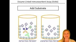 Quick Review of the Steps of an ELISA