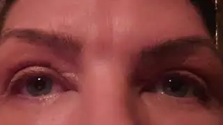 Purebeau Fibroblast Eye and Eyelid treatment