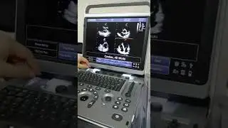 ebit 50 video características