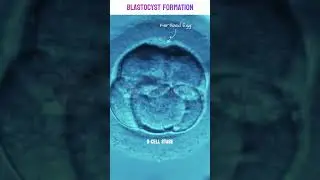 Real footage of Blastocyst Formation under microscope |  Human Embryo Development Stages #blastocyst