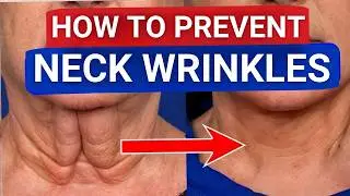 Neck Wrinkles: Simple Tips to Look Younger Fast
