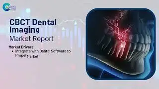 CBCT Dental Imaging Market Report 2024 (Global Edition)