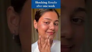 This Serum Erased My Dark Spots & Gave Me Glowing Skin