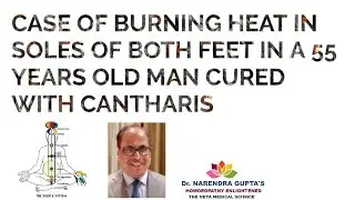 Case of burning heat in soles of both feet in a 55 years old man CURED with CANTHARIS