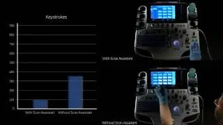 LOGIQ S8 Scan Assistant