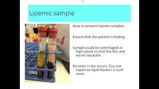 Pre analytical error