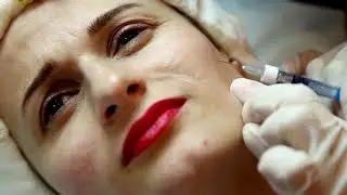 Botox &ndash; medizinische Fakten statt Mythen