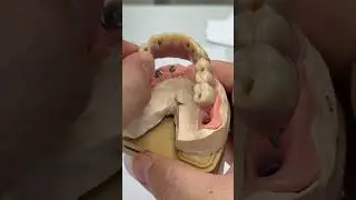 Solutions from 10 implants