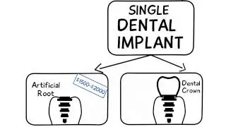 How Much Do Dental Implants Cost? | Daniel Daniel Dentistry