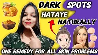 Dark Spots Remove in 3 Days | 100% Natural Home Remedy for Clear Skin 2025