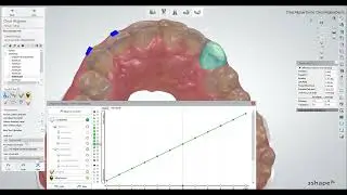 3Shape Clear Aligner Studio Demo