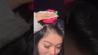 Не используйте гликолевую кислоту до просмотра этого видео! 😳