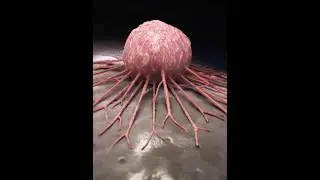Methylglyoxal - Impact on Cancer Cell Growth and Metastasis