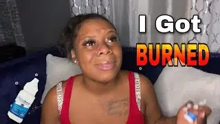 I GOT BURNED... by Ghost Bond Lace Glue !!! HORRIBLE EXPERIENCE