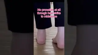 #pronation #gait #gaitanalysis #glutes #the_stabilisation_academy #thestabilisationacademy