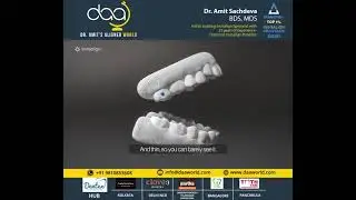 The future of your Teens Smile |  Invisalign