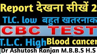 T.L C  ,w.B.C. Total count कितना बढ़ाने से blood cancer |Medicine treatment| Dr Ashutosh Ranjan