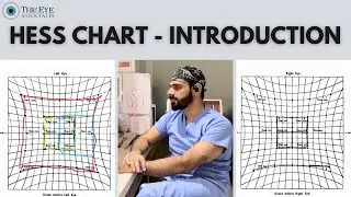 Hess Chart - Introduction