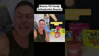 Braces VS Candy Orthodontist Reacts!