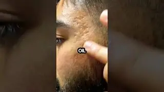 These Oils Help With Everything From Dry Skin to Anti Aging