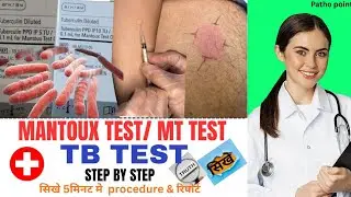 MT Test क्या है? | रिपोर्ट कैसे पढ़े | Mantoux Test Procedure, Result & Meaning | TB Test #healthtips