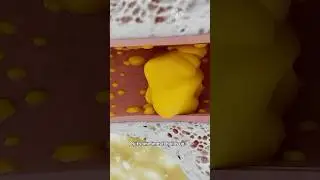 How To Remove Ear Wax Blockage The Right Way 🤔 Surgeon Reacts